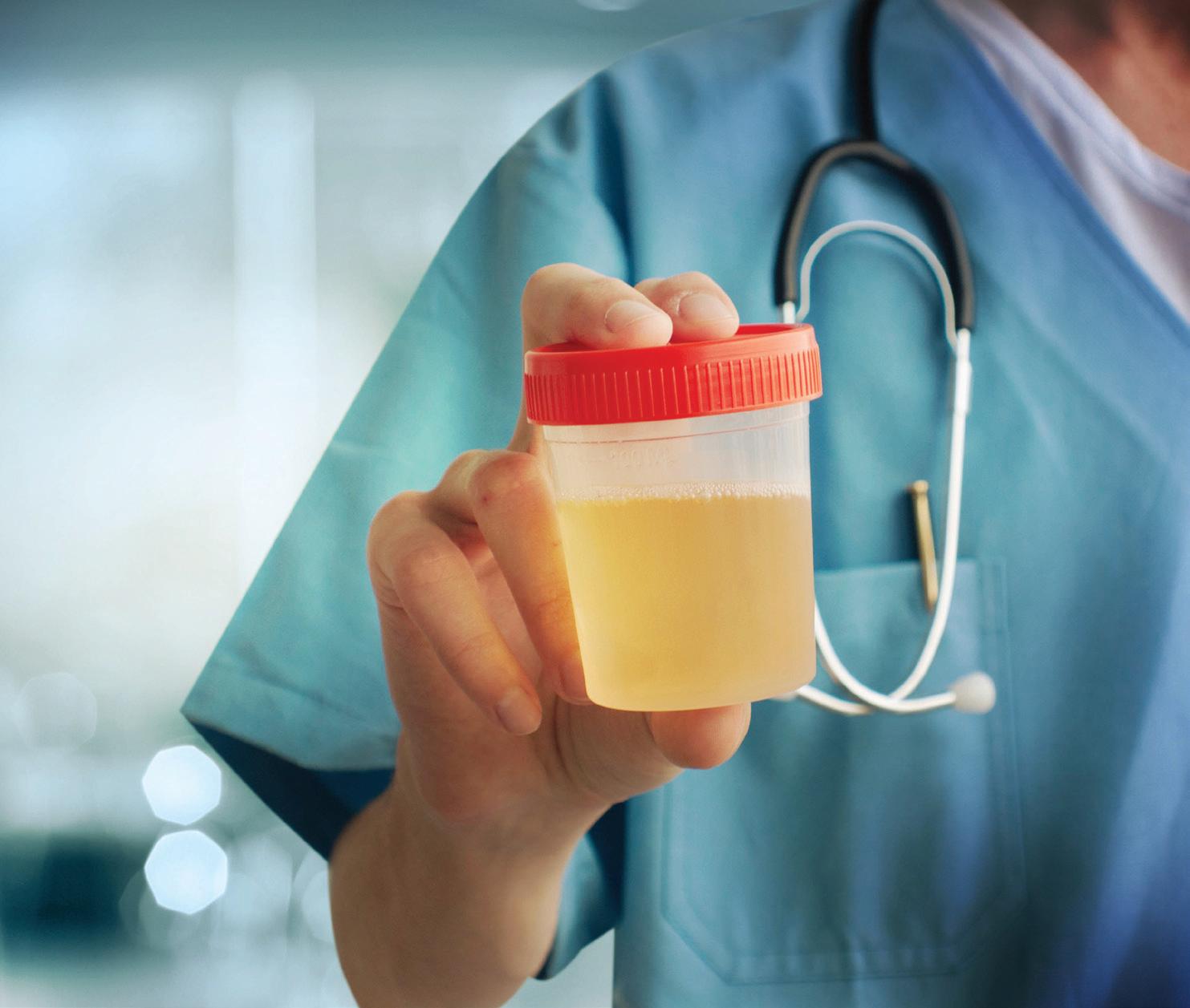 पेशाब के रंग से जानिए कितने स्वस्थ हैं आप